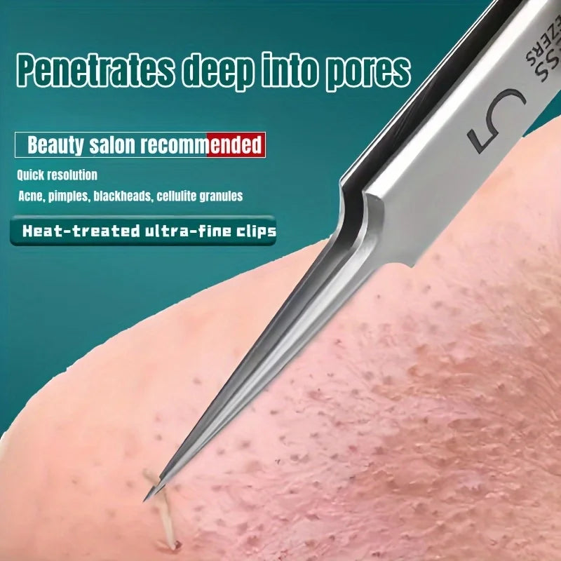 Blackhead Extractor Tweezers — Stainless Steel